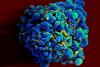 Journée mondiale de lutte contre le sida : l'espoir est dans les anticorps neutralisants à large spectre