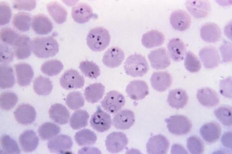Plasmodium falciparum dans des globules rouges en microscopie optique