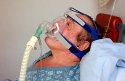 La VNI plus efficace que le masque à oxygène pour éviter l’hypoxémie à l’intubation