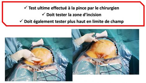 Évaluation de la qualité de l’anesthésie avant incision : tester la zone d’incision et plus haut en limite de champ