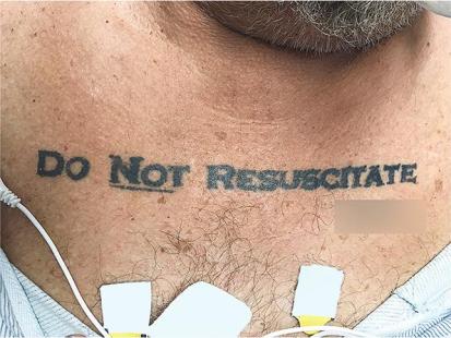 Tatouage "Do not resuscitate"