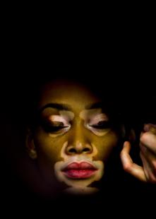 La mannequin Winnie Herzog sublime son vitiligo