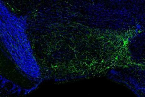 Image de microscopie montrant par fluorescence des neurones inhibiteurs (en vert) découverts dans le système olfactif.